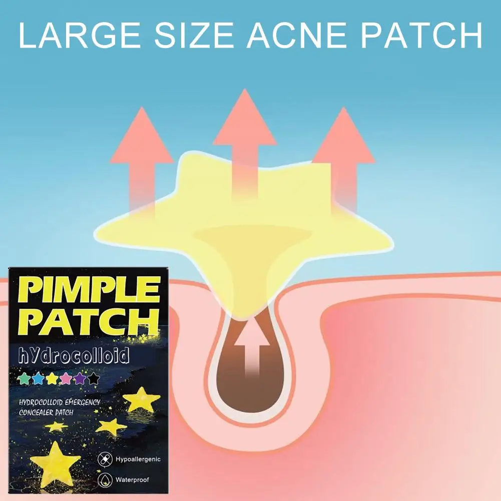 Sternförmige Pimple Patches – Hydrocolloid Pickel-Pflaster