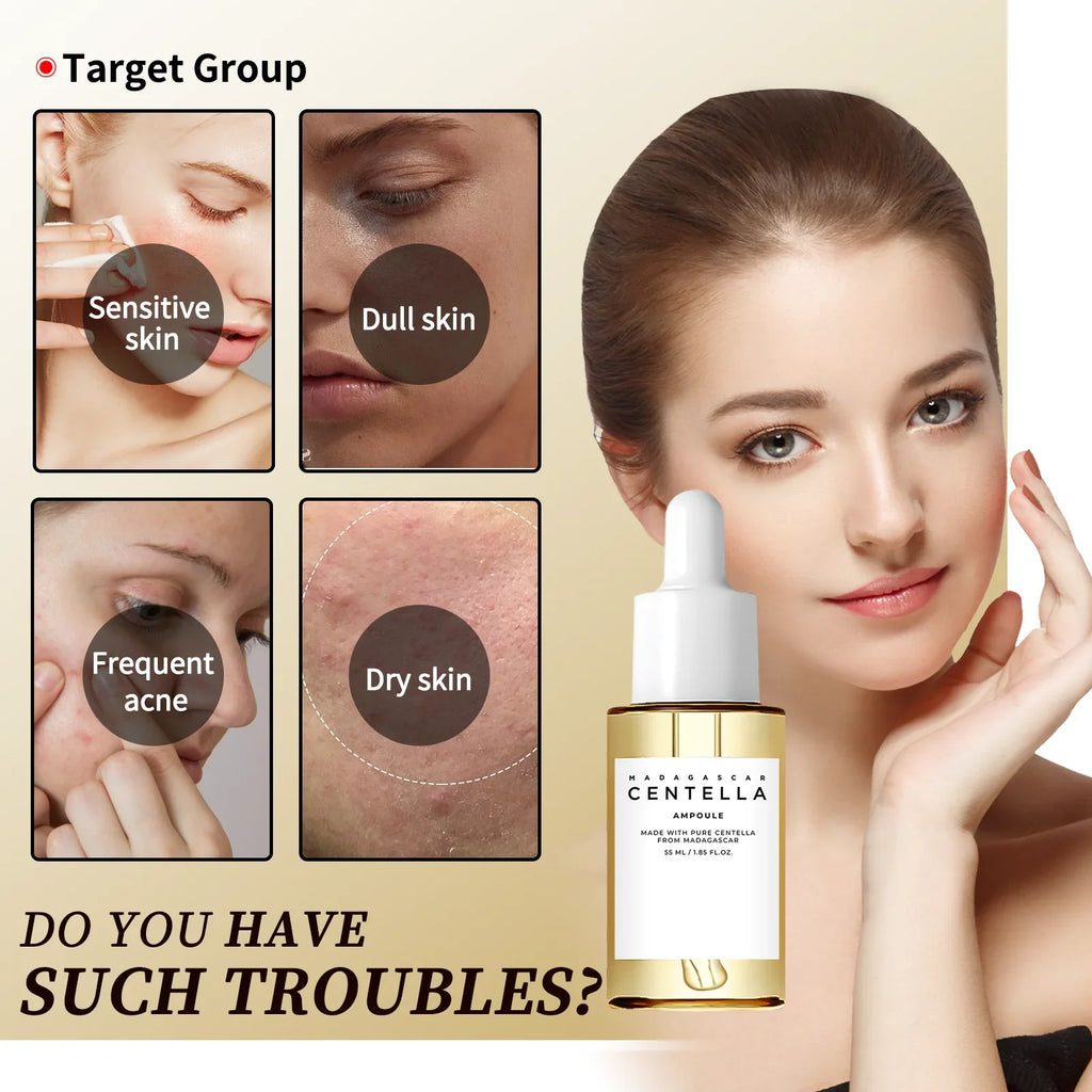 Centella Asiatica Serum – Beruhigung & Feuchtigkeit